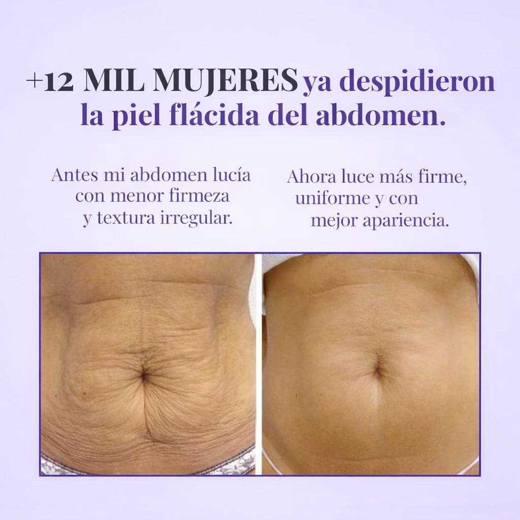 LYVIANA® - Reafirma y combate las Estrías y Flacidez Abdominal.